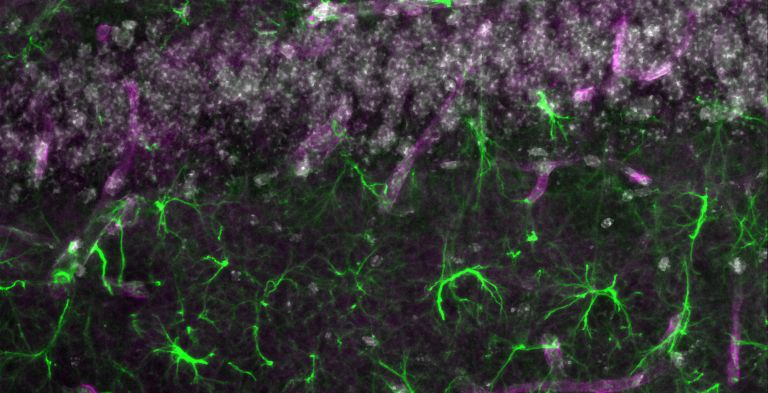 Immunohistochemistry staining of astrocytes in the CA1 region of hippocampus in a mouse brain. Aquaporin-4 on astrocyte endfeet outline blood vessels (magenta),  glial fibrillary acid within the main processes of astrocytes (green) and 4',6-diamidino-2-phenylindole labeling cell nuclei (gray).