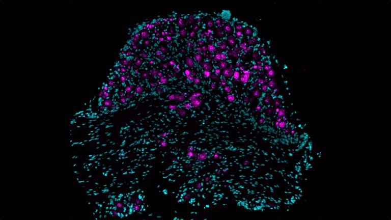 Bild der Piezo2-Genexpression (in Magenta dargestellt) in Schnitten aus dem lumbalen Spinalwurzelganglien von Mäusen.